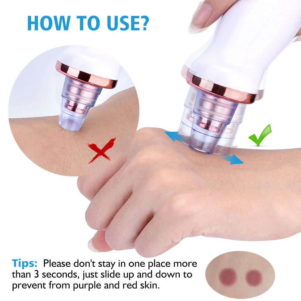 Electric Blackhead Remover | Blackhead Suction Vacuum | Terni Beauty