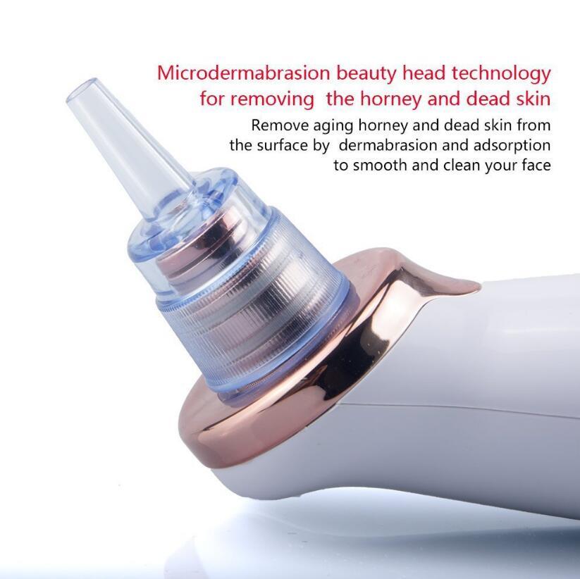 Electric Blackhead Remover | Blackhead Suction Vacuum | Terni Beauty
