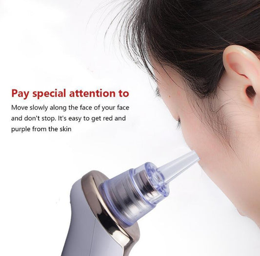 Electric Blackhead Remover | Blackhead Suction Vacuum | Terni Beauty